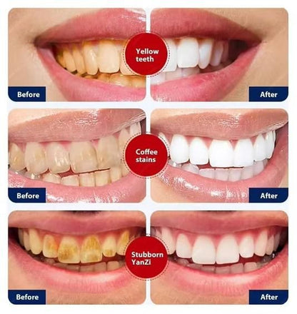 ShineX Whitening™ Smoke Stains White Plus Toothpaste (Pack of 2)