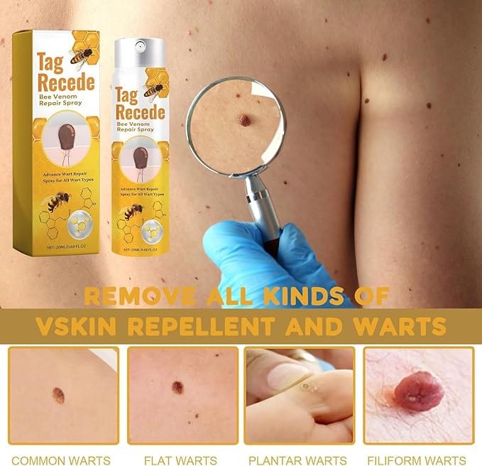 BeeClear™️ Bee Venom Wart Remover Spray (Pack of 2)